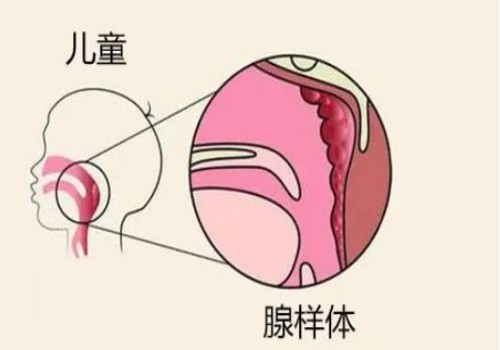 二胎時(shí)間間隔多久性別有差異，附生二胎注意事項(xiàng)