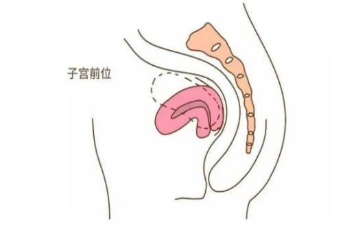 11號(hào)染色體倒位對(duì)胎兒的影響很大，附11號(hào)染色體倒位的癥狀